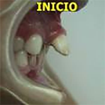 Figura 14 Fotografía inicial