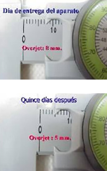 Figuras 20 y 21 Mediciones
