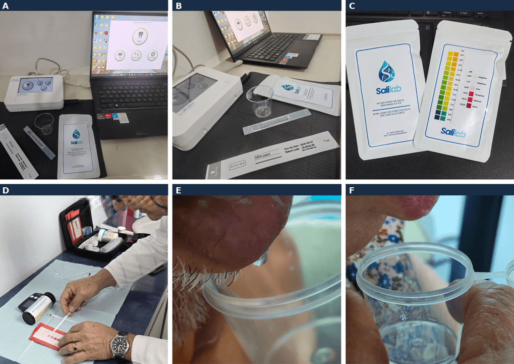Figura 2. Plataforma SaliLab y protocolo de toma de muestra salival para el cálculo del índice IBAR. (A) Equipo SaliLab conectado a estación de control, con tiras reactivas y vaso de recolección. (B) Comparación con el sistema de referencia SillHa (ARKRAY) empleado en la validación comparativa. (C) Tiras reactivas SaliLab para pH y oxido nítrico/nitritos salivales, con escala de color de referencia. (D) Lectura de la tira de pH sobre campo estéril. (E, F) Recolección de muestra de saliva no estimulada mediante método de drenaje pasivo. Fotografías propias de los autores; rasgos faciales anonimizados digitalmente para preservar la confidencialidad.