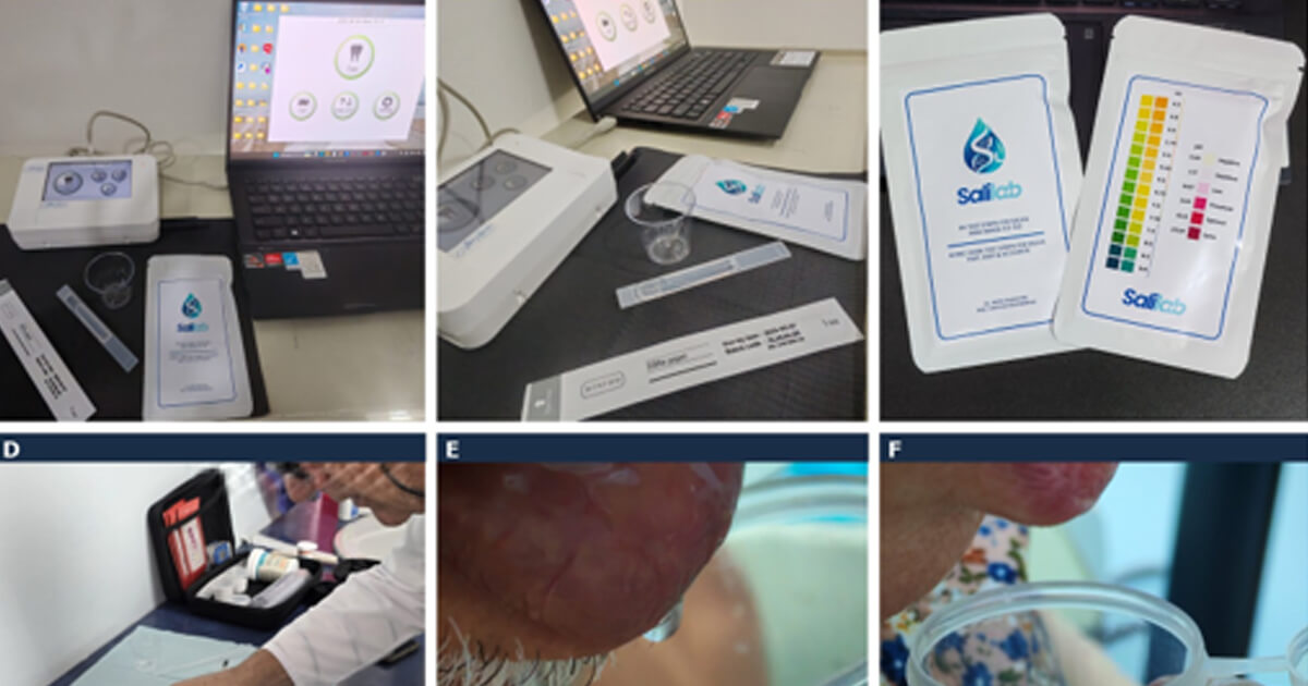 Bioestimulación láser como modulador de la microbiota oral: revisión de la literatura y su relación con biomarcadores salivales