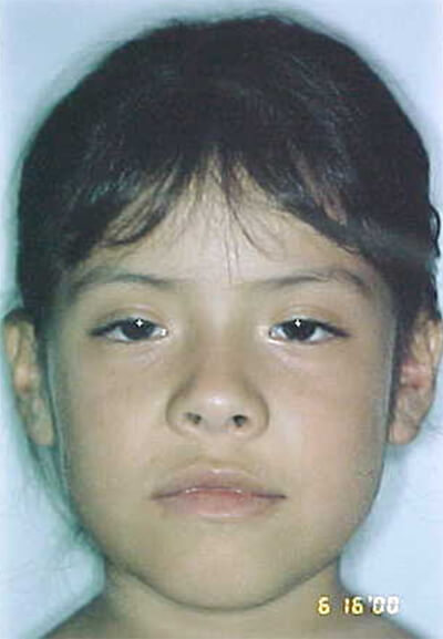 Fig. 1 Inicial