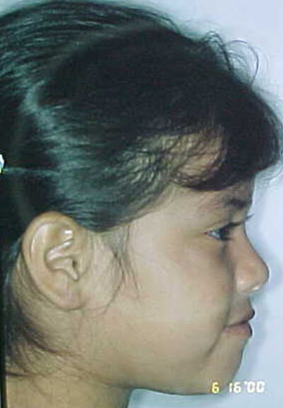 Fig. 2 Perfil derecho