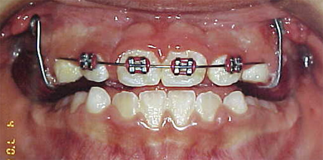 Fig. 6