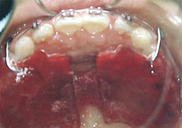 Fig. 7