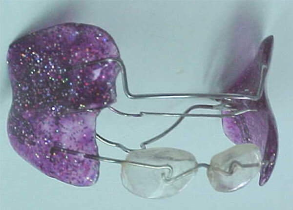 Fig. 9 Frankel III