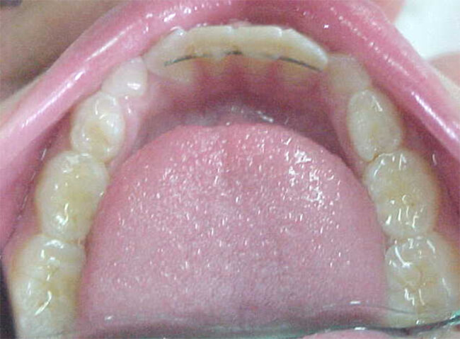Fig. 11