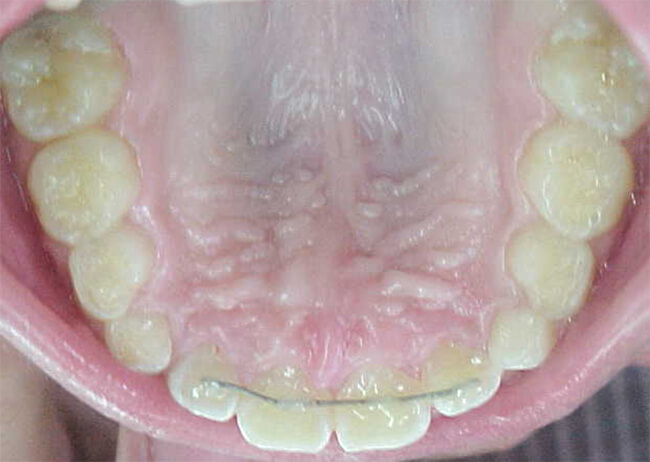 Fig. 12