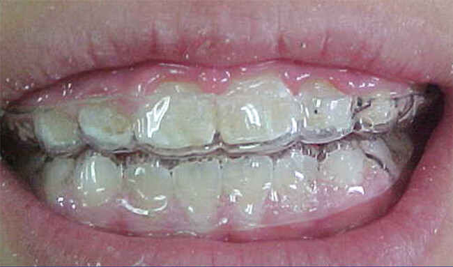 Fig. 13