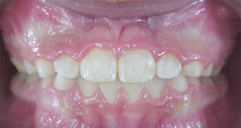 Fig. 14