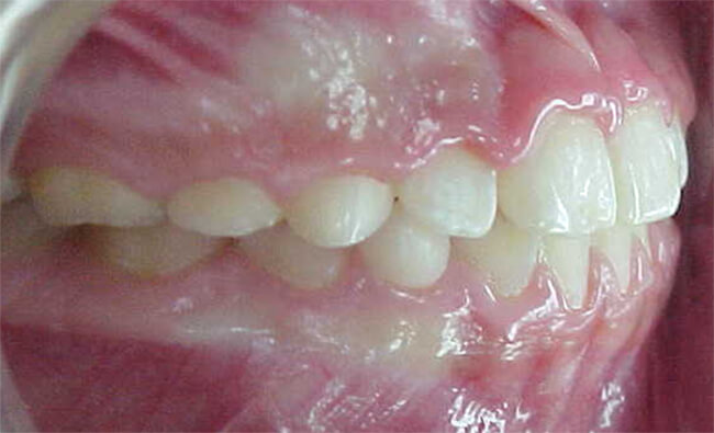 Fig. 15