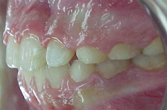 Fig. 16