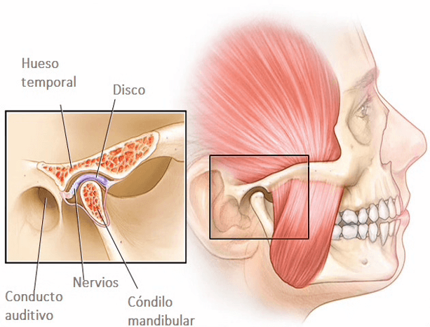 Fig 1. Complejo Cóndilo Discal- Prinicpales estructuras afectadas en la DATM (Tomado de MayoClinic. 2019)8